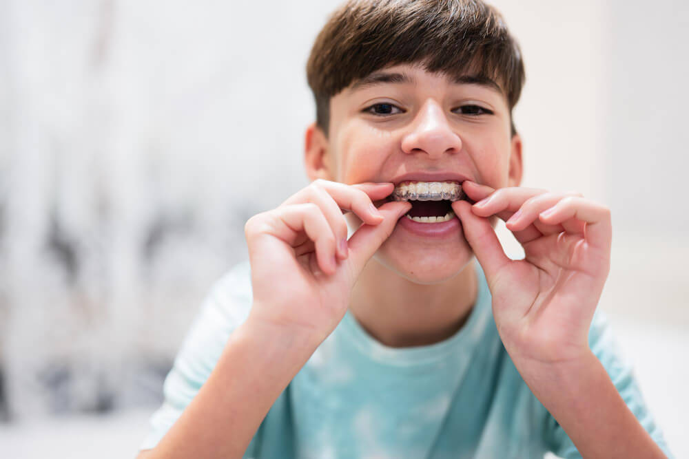 invisalign first