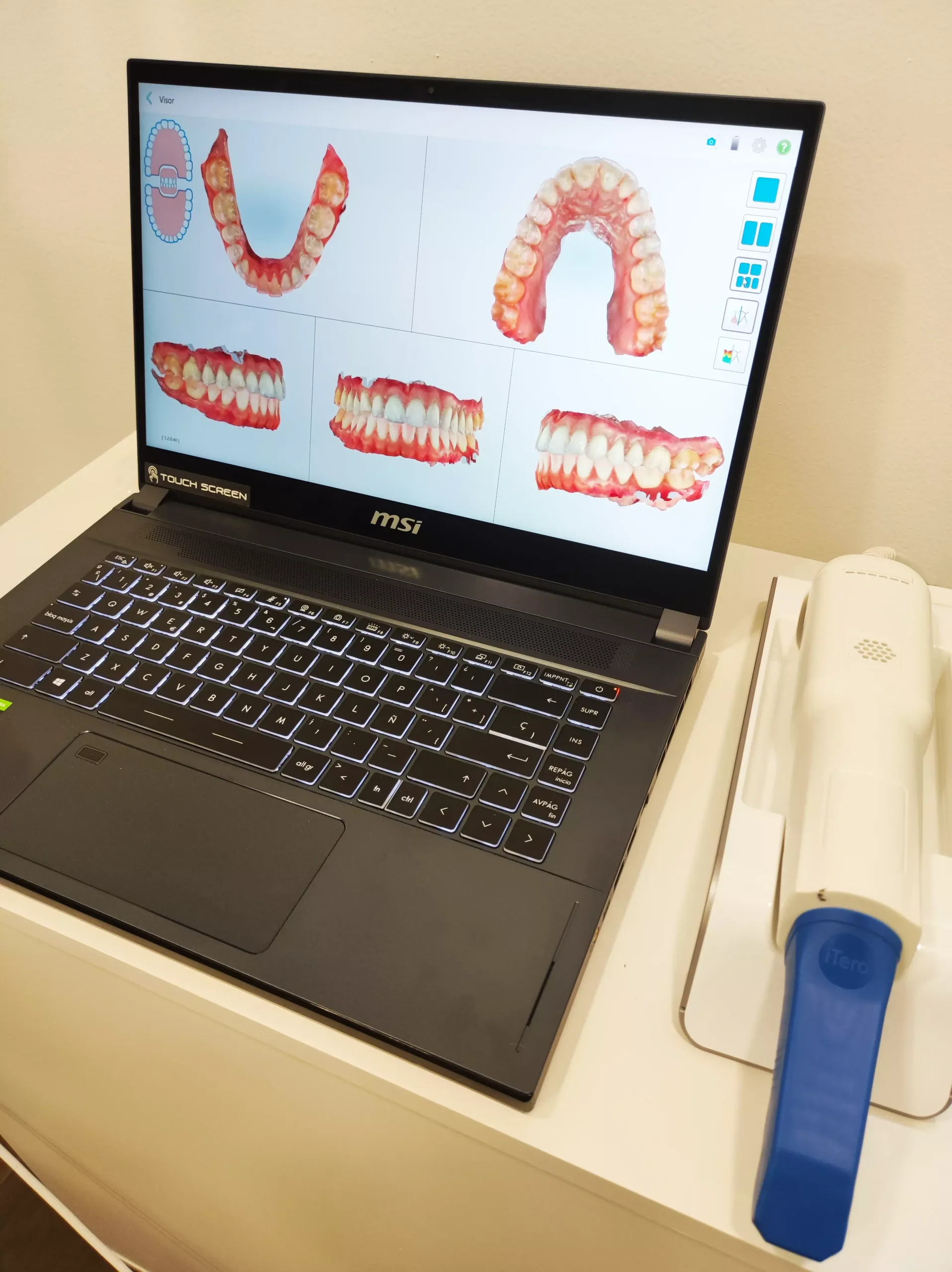 invisalign en las rozas